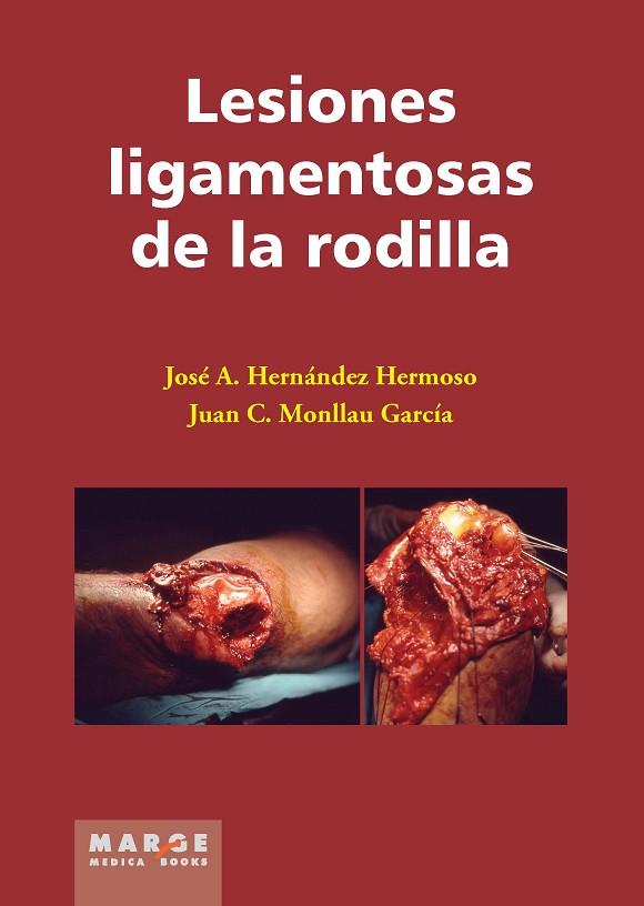 LESIONES LIGAMENTOSAS DE LA RODILLA | 9788415340263 | HERNANDEZ HERMOSO,JOSE A./MONLLAU GARCIA,JUAN C. | Llibreria Geli - Llibreria Online de Girona - Comprar llibres en català i castellà