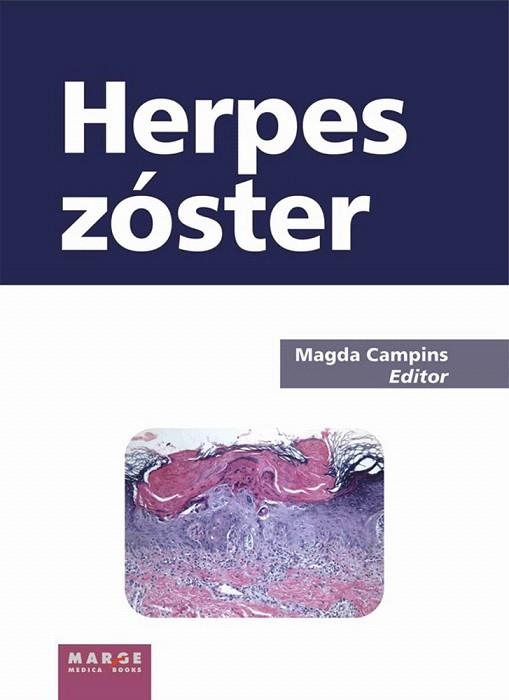 HERPES ZOSTER | 9788492442812 | CAMPINS,MAGDA | Llibreria Geli - Llibreria Online de Girona - Comprar llibres en català i castellà