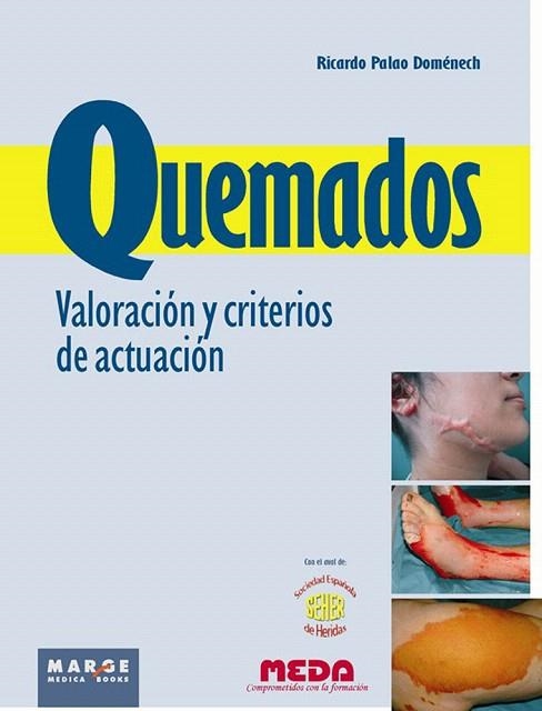 QUEMADOS.VALORACION Y CRITERIOS DE ACTUACION | 9788415340140 | PALAO DOMENECH,RICARDO | Libreria Geli - Librería Online de Girona - Comprar libros en catalán y castellano