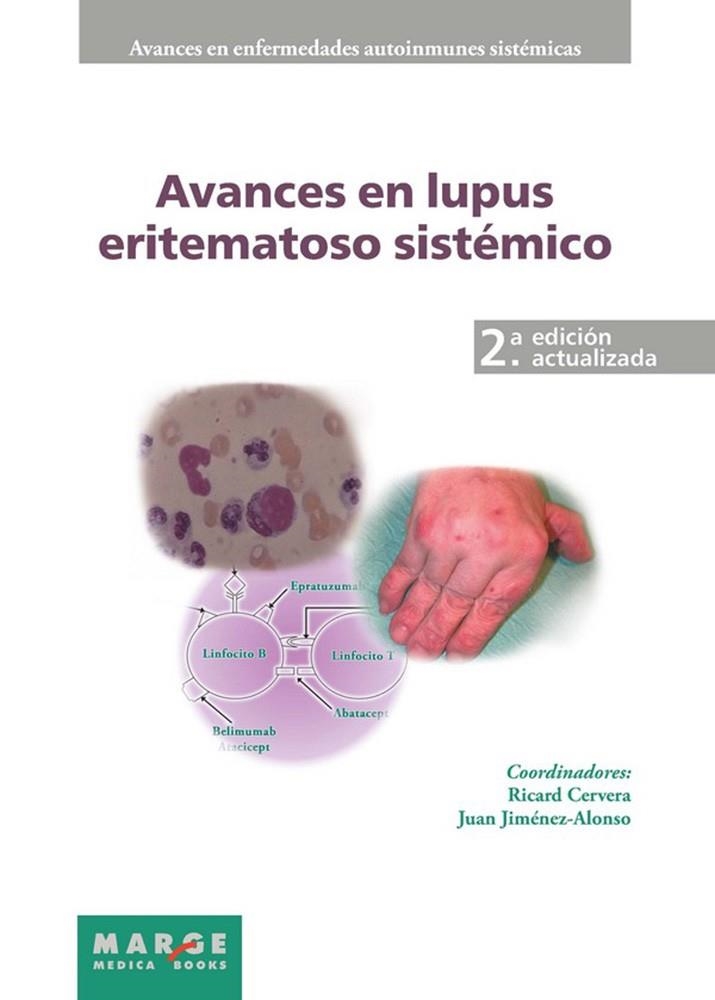 AVANCES EN LUPUS ERITEMATOSO SISTEMICO 2ED 2011 | 9788415340201 | CERVERA,RICARD/JIMENEZ ALONSO,JUAN | Llibreria Geli - Llibreria Online de Girona - Comprar llibres en català i castellà