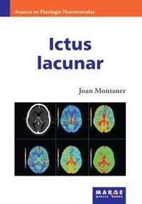 ICTUS LACUNAR | 9788415340393 | MONTANER,JOAN | Libreria Geli - Librería Online de Girona - Comprar libros en catalán y castellano