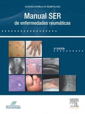 MANUAL SER DE ENFERMEDADES REUMATICAS(6ª EDICION 2014) | 9788490229033 | Llibreria Geli - Llibreria Online de Girona - Comprar llibres en català i castellà