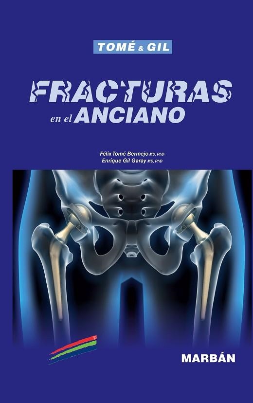 FRACTURAS EN EL ANCIANO | 9788417184919 | Llibreria Geli - Llibreria Online de Girona - Comprar llibres en català i castellà