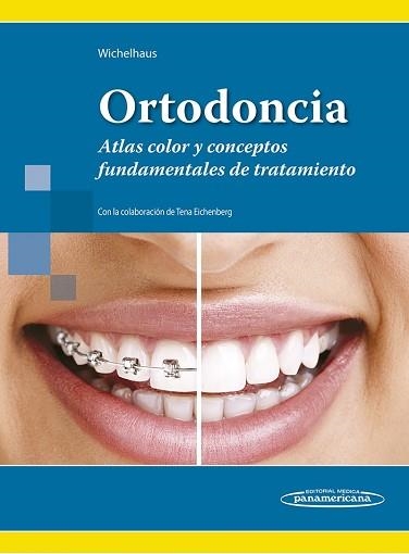 ORTODONCIA.ATLAS COLOR Y CONCEPTOS FUNDAMENTALES DE TRATAMIENTO | 9786079356880 | WICHELHAUS,ANDREA | Llibreria Geli - Llibreria Online de Girona - Comprar llibres en català i castellà