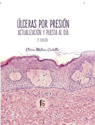 ÚLCERAS POR PRESION(3ª EDICIÓN) | 9788491496328 | MOLINA CASTILLO, ELVIRA | Llibreria Geli - Llibreria Online de Girona - Comprar llibres en català i castellà