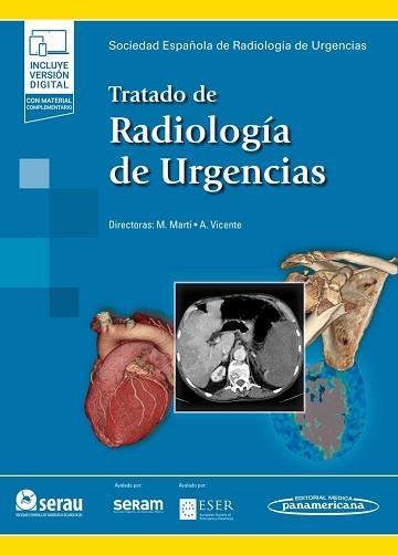 TRATADO DE RADIOLOGÍA DE URGENCIAS | 9788491106968 | MARTÍ DE GRACIA,MILAGROS/VICENTE BÁRTULOS,AGUSTINA | Llibreria Geli - Llibreria Online de Girona - Comprar llibres en català i castellà