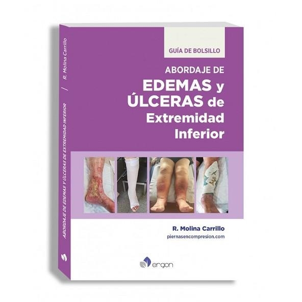 EDEMAS Y ÚLCERAS DE EXTREMIDAD INFERIOR. GUÍA DE BOLSILLO | 9788419230966 | MOLINA CARRILLO, RUBÉN | Llibreria Geli - Llibreria Online de Girona - Comprar llibres en català i castellà