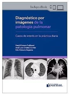 DIAGNOSTICO POR IMAGENES DE LA PATOLOGIA PULMONAR | 9789878452746 | KIMURA | Llibreria Geli - Llibreria Online de Girona - Comprar llibres en català i castellà