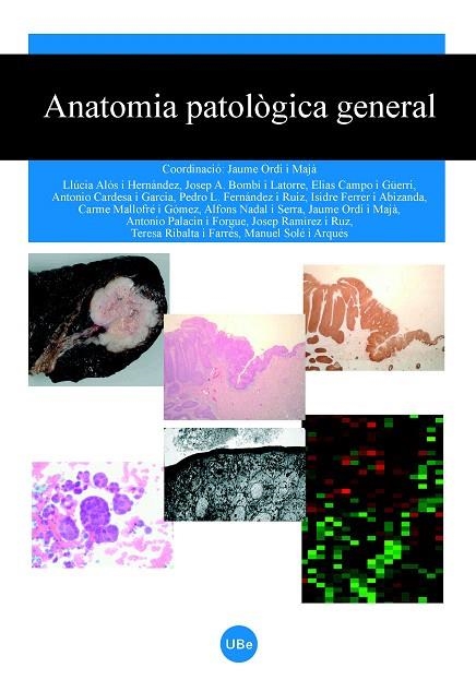 ANATOMIA PATOLOGICA GENERAL | 9788447531295 | Llibreria Geli - Llibreria Online de Girona - Comprar llibres en català i castellà